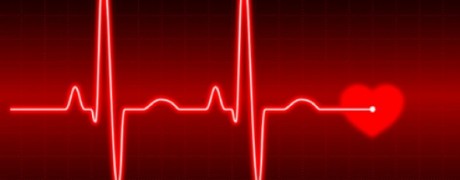 EKG of a heartbeat - treatment aftercare and monitoring